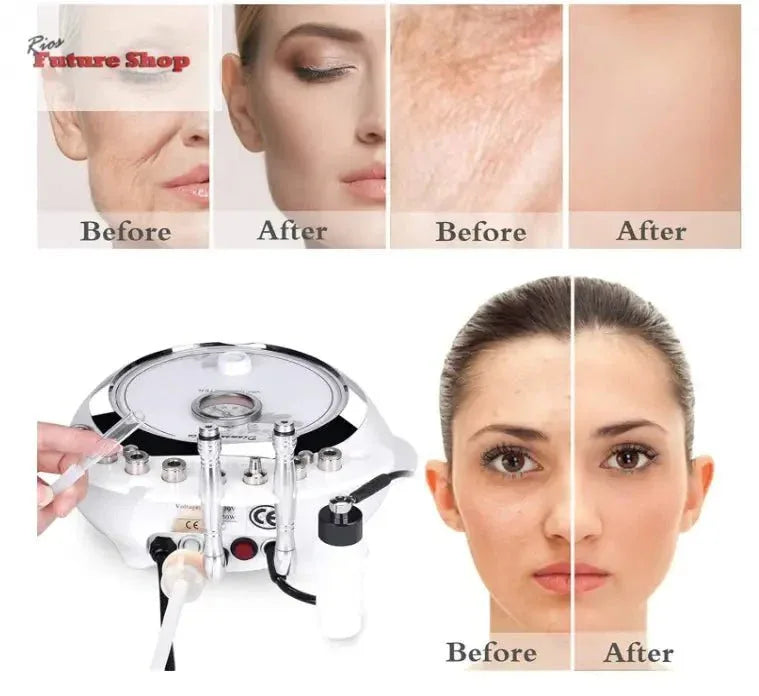 3 em 1 dispositivo profissional de dermoabrasão, beleza facial - Rios Future Shop