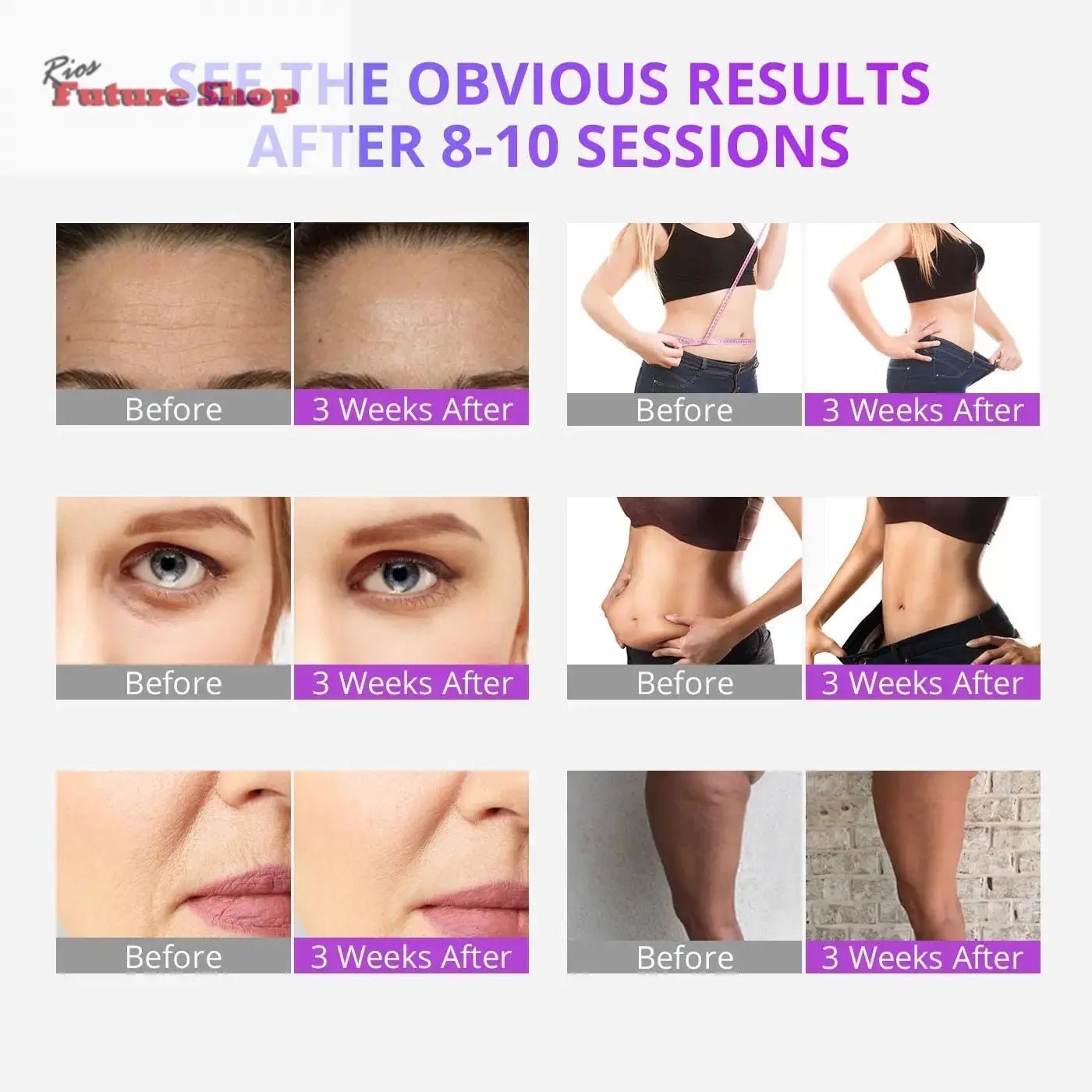 5-In-1-Ultrasonic-40K-Cavitation-Vacuum-Fat-Loss-Body-Shaping-Machine-DSers-100052775 - Rios Future Shop