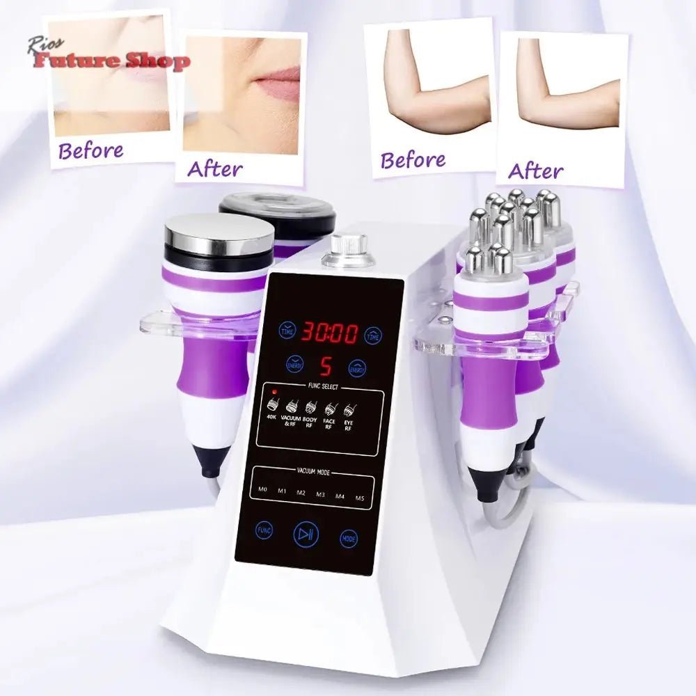 5-In-1-Ultrasonic-40K-Cavitation-Vacuum-Fat-Loss-Body-Shaping-Machine-DSers-100051445 - Rios Future Shop