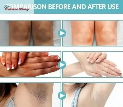 Crema aclarante blanqueadora - Rios Future Shop