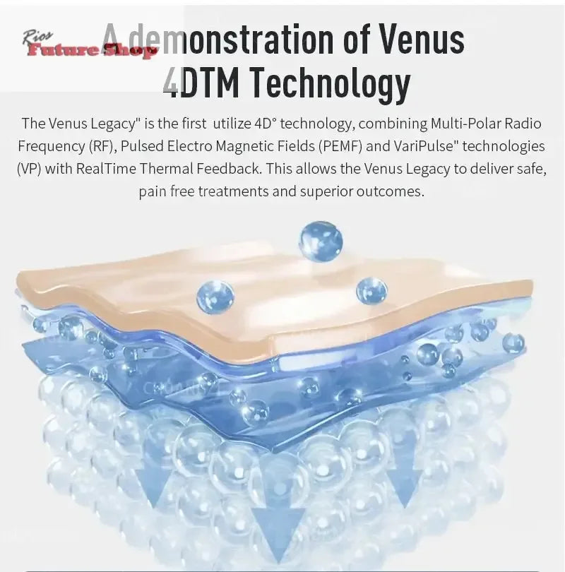 Venus Legacy Pro Skin Tightening & Vacuum Machine - Rios Future Shop
