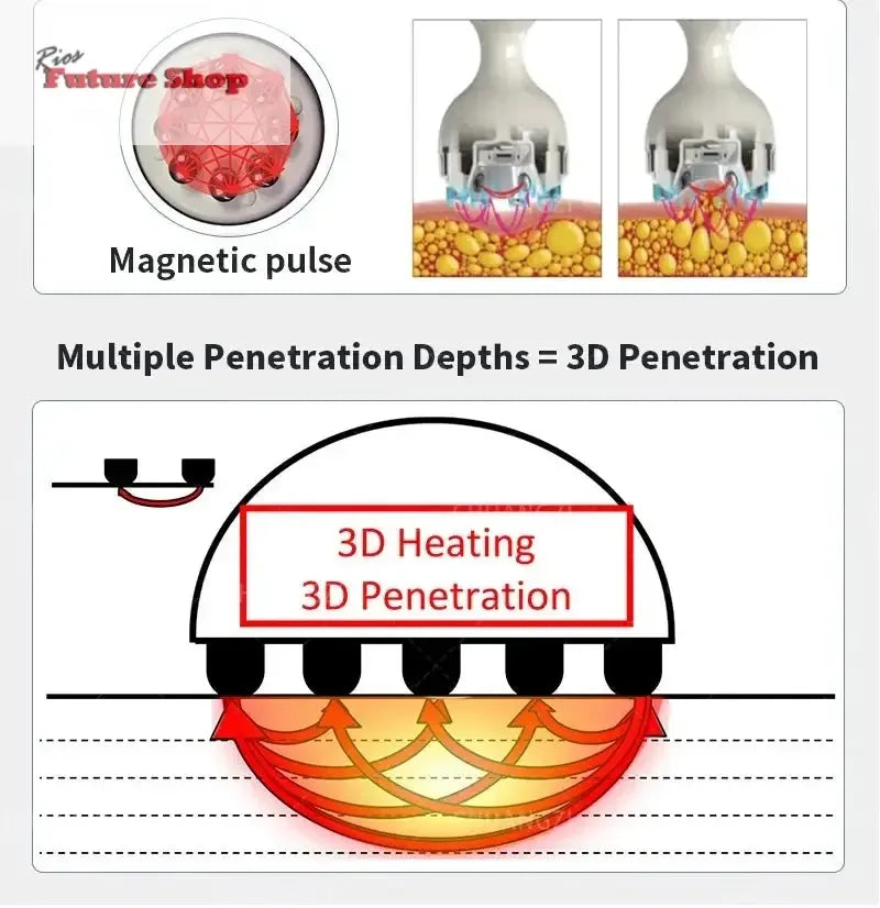 Venus Legacy Pro Skin Tightening & Vacuum Machine - Rios Future Shop