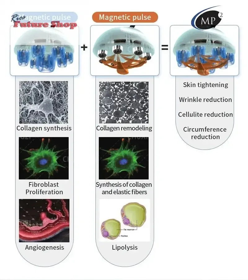 Venus Legacy Pro Skin Tightening & Vacuum Machine - Rios Future Shop