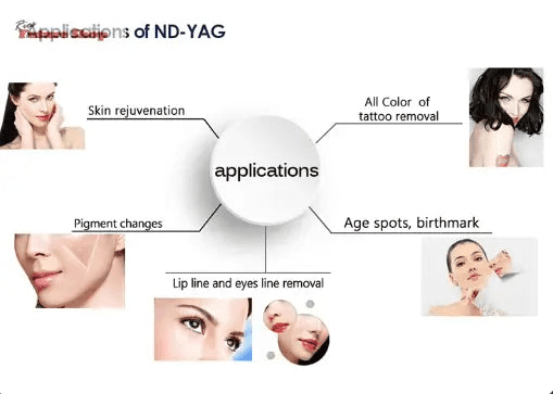 adss-picosecond-laser-111888 - Rios Future Shop