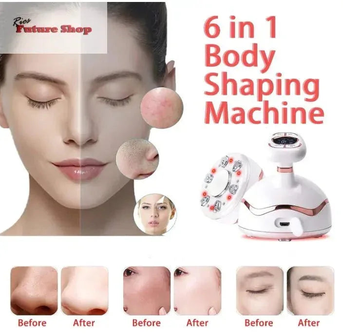 Dispositivo de beleza ultrassónico ultra-som 6 em 1 - Rios Future Shop