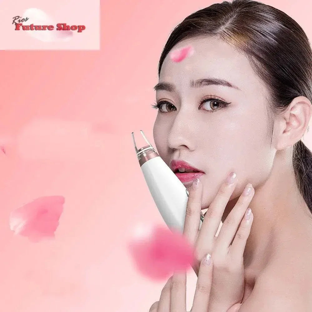 Maquina de Limpeza pele,limpeza dos poros - Rios Future Shop