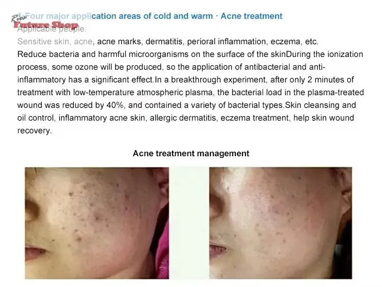 Newest 8 in 1Fusion Plasma Scalp Diamond Stamp Jet Plasma Professional Lase Fibroblast Ozone Wart Spray Pen Removal Salon - Rios Future Shop