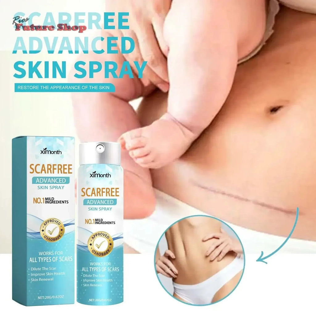 Spray Clareador de Cicatrizes para Pele Corporal - Rios Future Shop