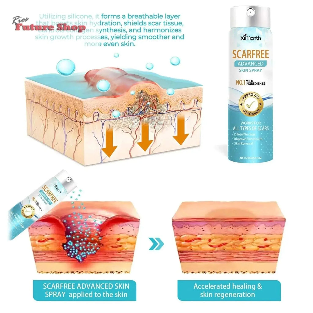 Spray Clareador de Cicatrizes para Pele Corporal - Rios Future Shop