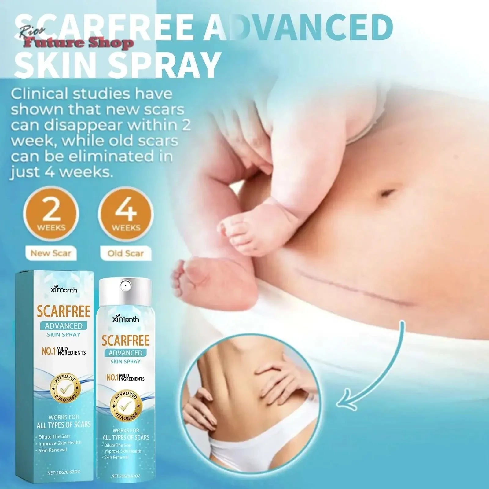 Spray Clareador de Cicatrizes para Pele Corporal - Rios Future Shop